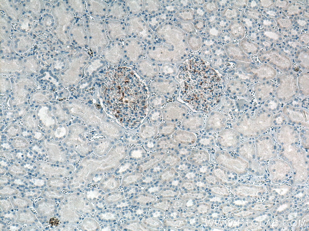 Immunohistochemistry (IHC) staining of human kidney tissue using INF2 Monoclonal antibody (66910-1-Ig)