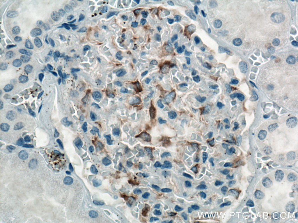 Immunohistochemistry (IHC) staining of human kidney tissue using INF2 Monoclonal antibody (66910-1-Ig)