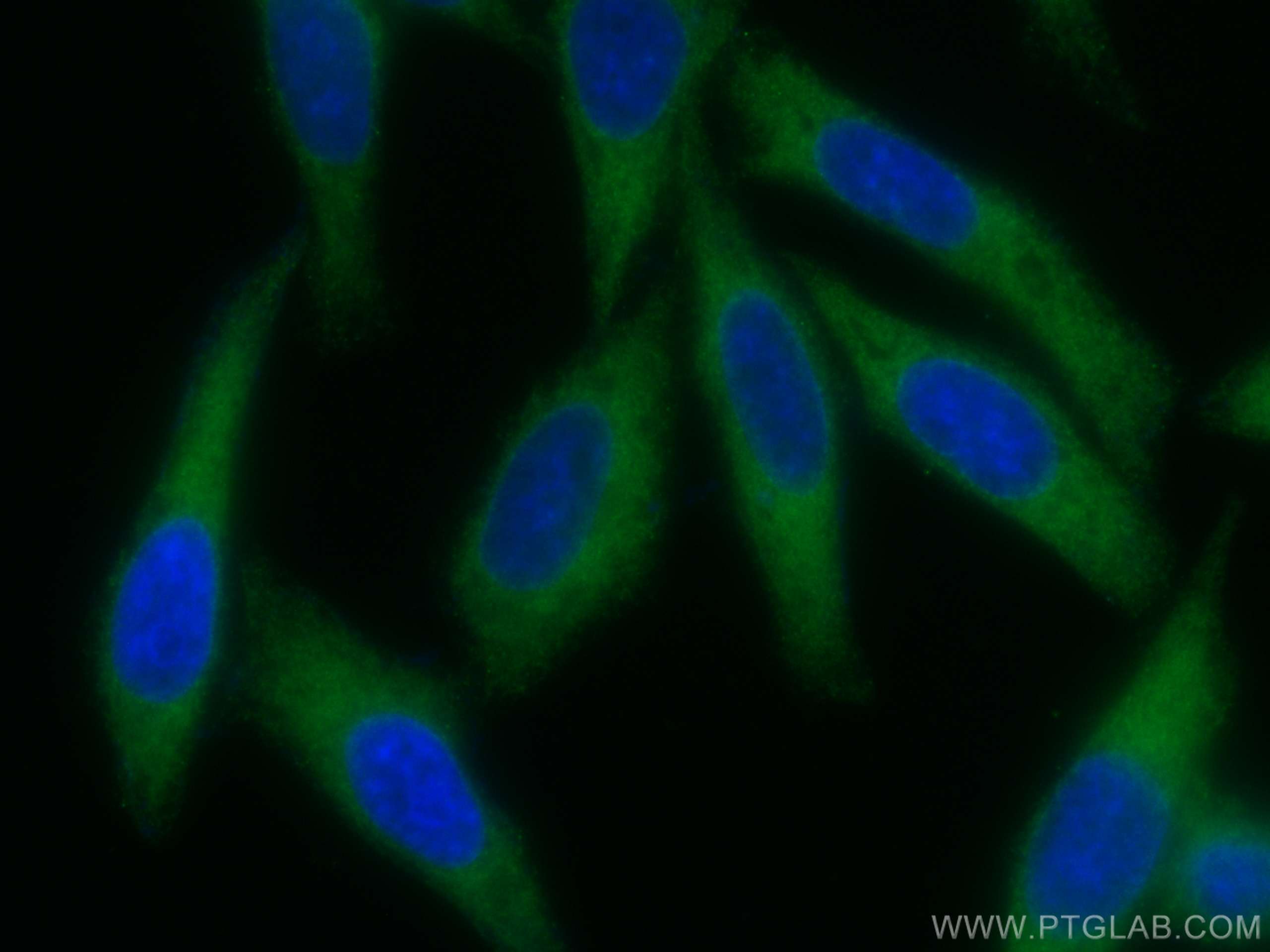 Immunofluorescence (IF) / fluorescent staining of HepG2 cells using CoraLite® Plus 488-conjugated INF2 Polyclonal anti (CL488-20466)