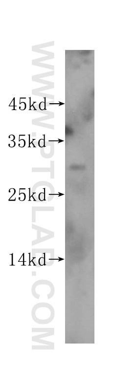 Western Blot (WB) analysis of human heart tissue using ING1-specific Polyclonal antibody (16185-1-AP)