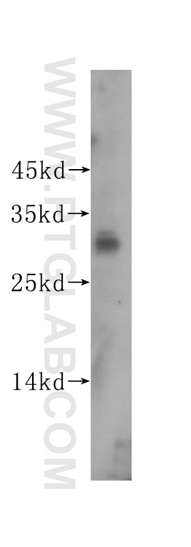 Western Blot (WB) analysis of human heart tissue using ING1-specific Polyclonal antibody (16185-1-AP)