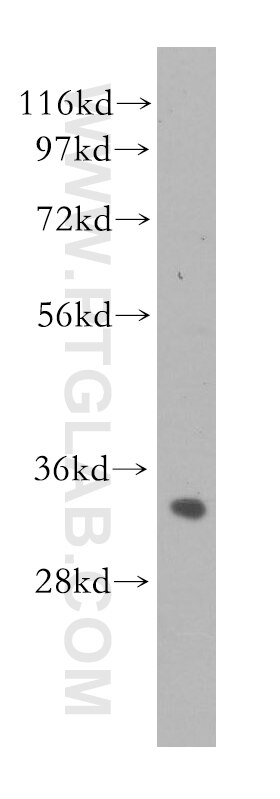 Western Blot (WB) analysis of human liver tissue using ING2 Polyclonal antibody (11560-1-AP)