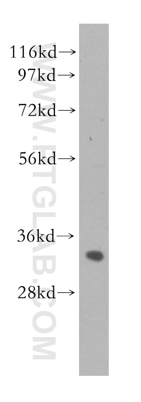 WB analysis of human liver using 11560-1-AP