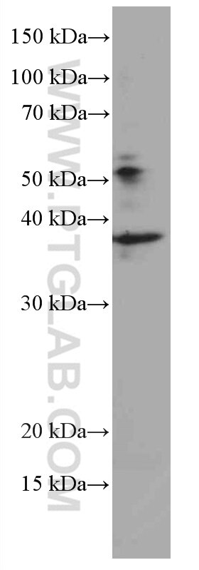 Western Blot (WB) analysis of T-47D cells using ING2 Monoclonal antibody (66512-1-Ig)