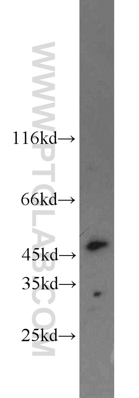 Western Blot (WB) analysis of mouse uterus tissue using ING3 Polyclonal antibody (10905-1-AP)
