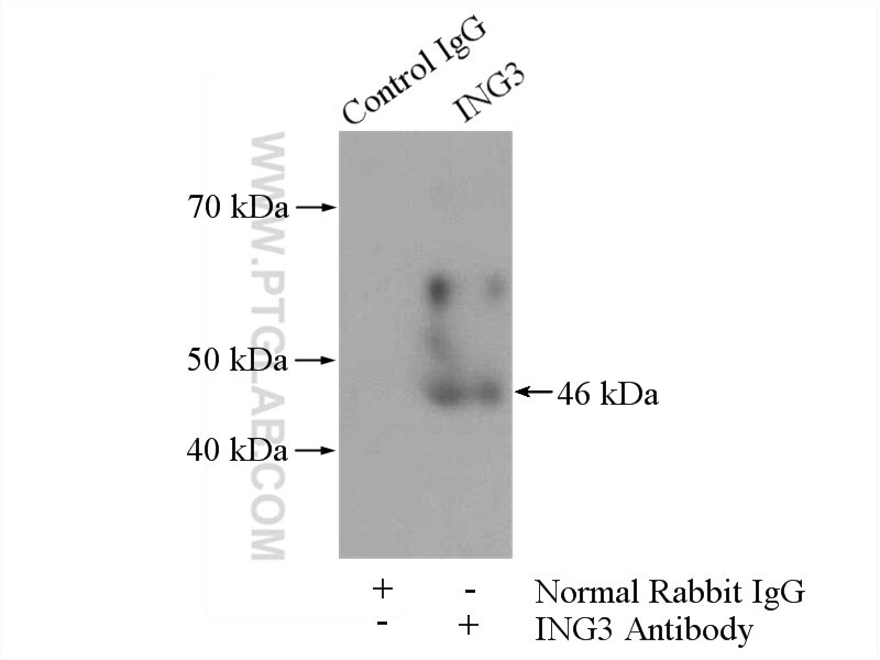 Immunoprecipitation (IP) experiment of mouse kidney tissue using ING3-specific Polyclonal antibody (16187-1-AP)