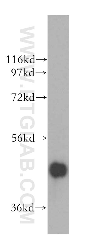 WB analysis of mouse kidney using 16187-1-AP