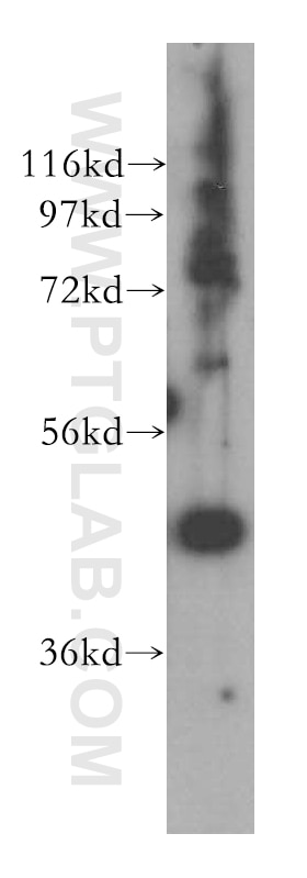 Western Blot (WB) analysis of mouse heart tissue using ING3-specific Polyclonal antibody (16187-1-AP)