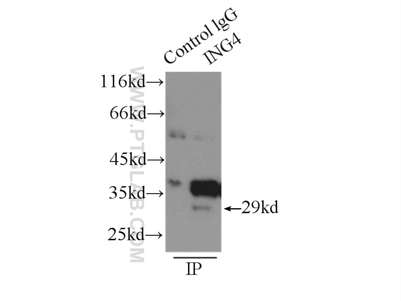 Immunoprecipitation (IP) experiment of HEK-293 cells using ING4 Polyclonal antibody (10617-1-AP)