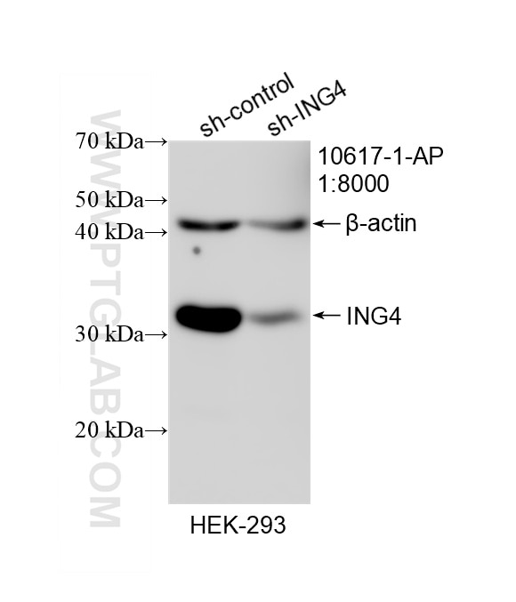 Western Blot (WB) analysis of HEK-293 cells using ING4 Polyclonal antibody (10617-1-AP)