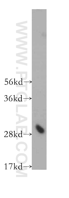 Western Blot (WB) analysis of HEK-293 cells using ING4 Polyclonal antibody (10617-1-AP)