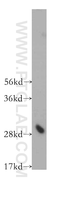 WB analysis of HEK-293 using 10617-1-AP