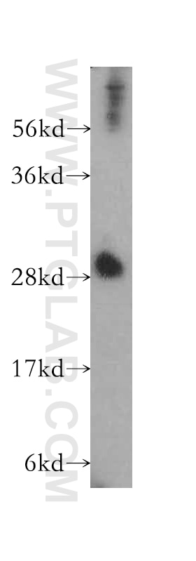 Western Blot (WB) analysis of HeLa cells using ING4 Polyclonal antibody (10617-1-AP)