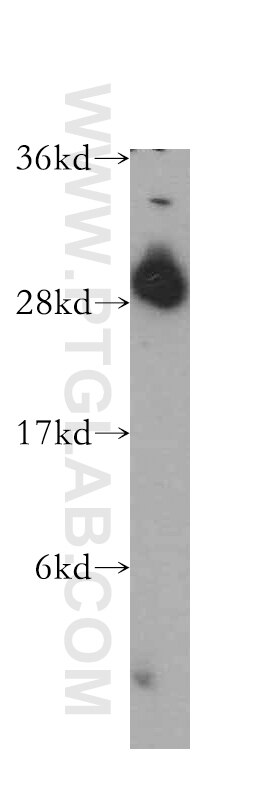 Western Blot (WB) analysis of HEK-293 cells using ING4 Polyclonal antibody (10617-1-AP)