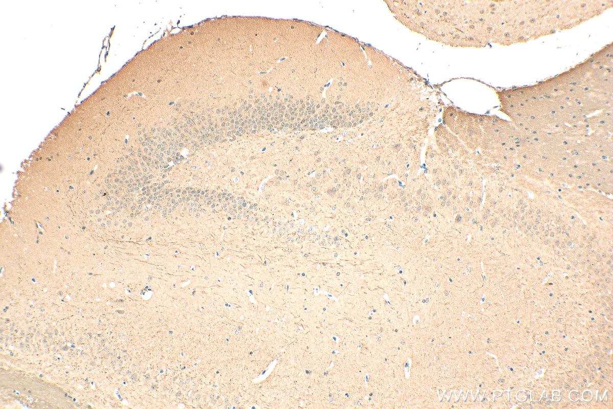 Immunohistochemistry (IHC) staining of mouse brain tissue using ING4 Polyclonal antibody (10896-1-AP)