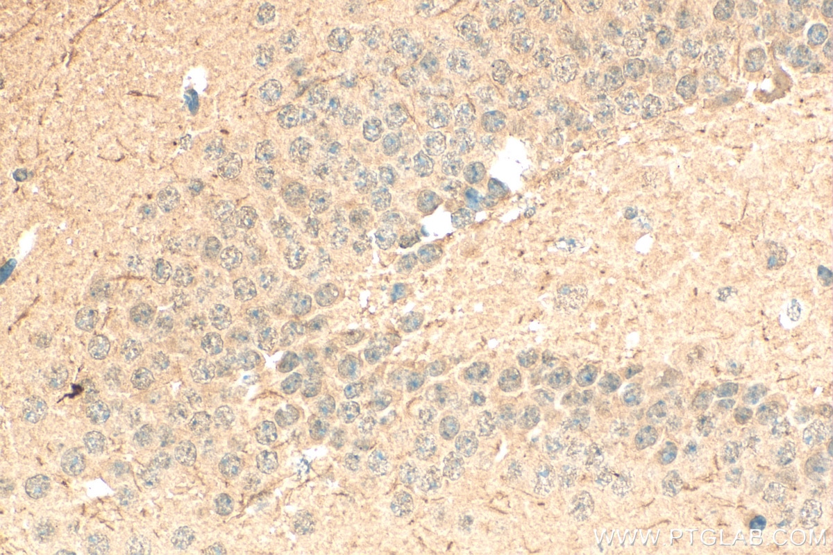 Immunohistochemistry (IHC) staining of mouse brain tissue using ING4 Polyclonal antibody (10896-1-AP)