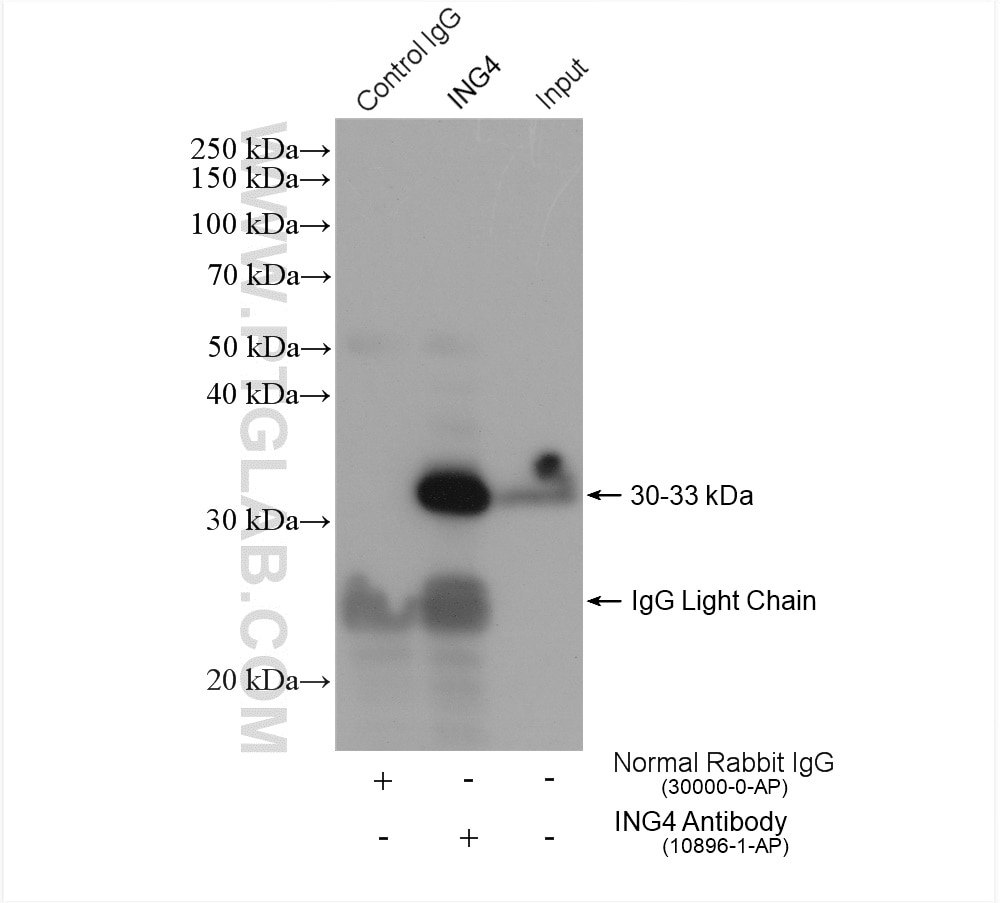 IP experiment of HEK-293 using 10896-1-AP