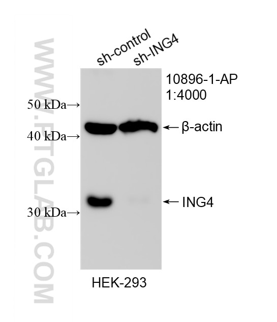 Western Blot (WB) analysis of HEK-293 cells using ING4 Polyclonal antibody (10896-1-AP)