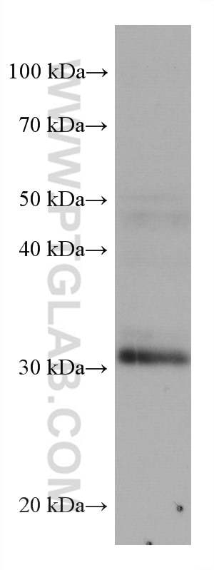 Western Blot (WB) analysis of rat brain tissue using ING4 Monoclonal antibody (67754-1-Ig)