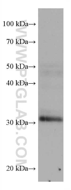 WB analysis of rat brain using 67754-1-Ig