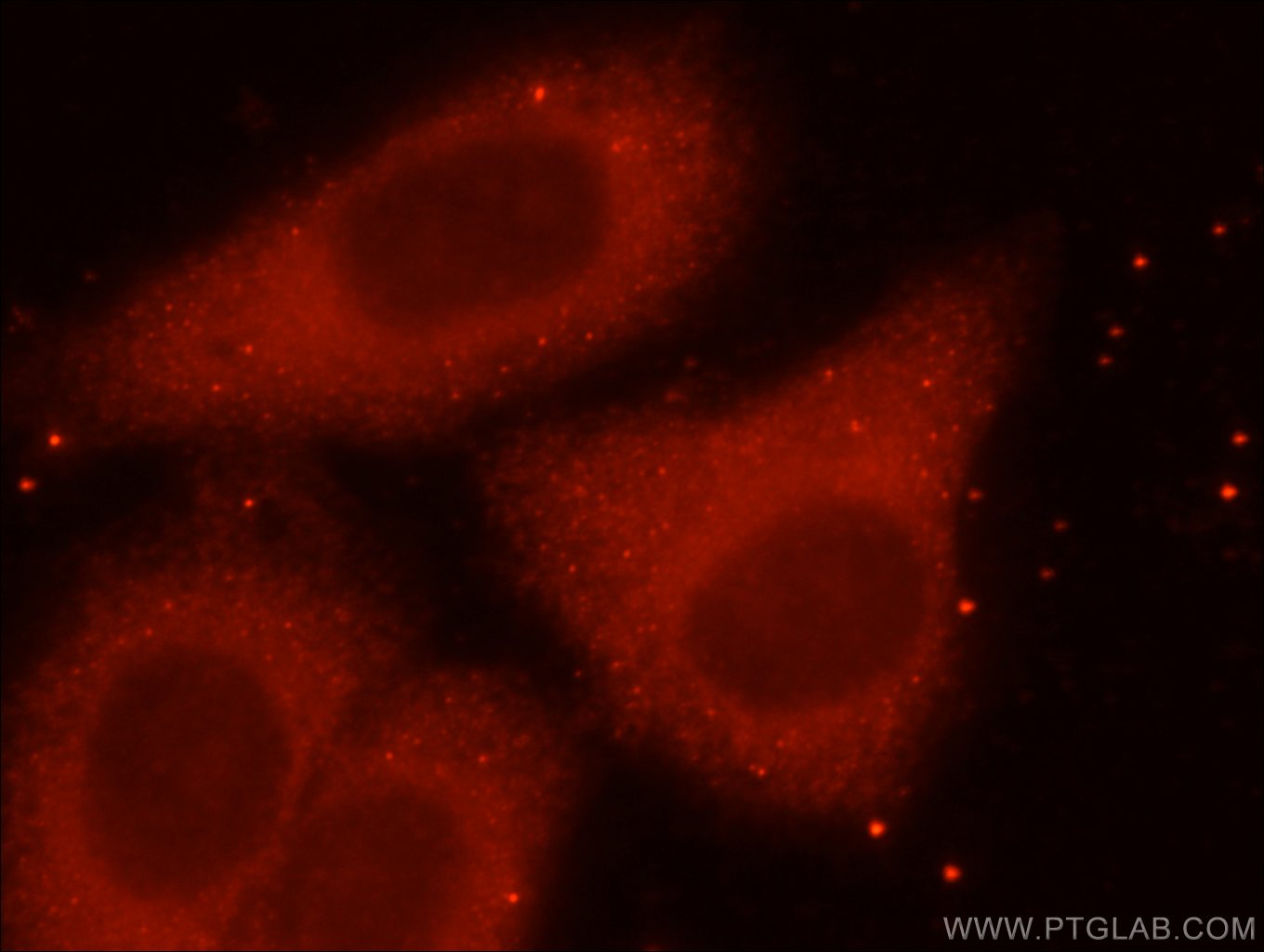 Immunofluorescence (IF) / fluorescent staining of HepG2 cells using ING4-specific Polyclonal antibody (16188-1-AP)