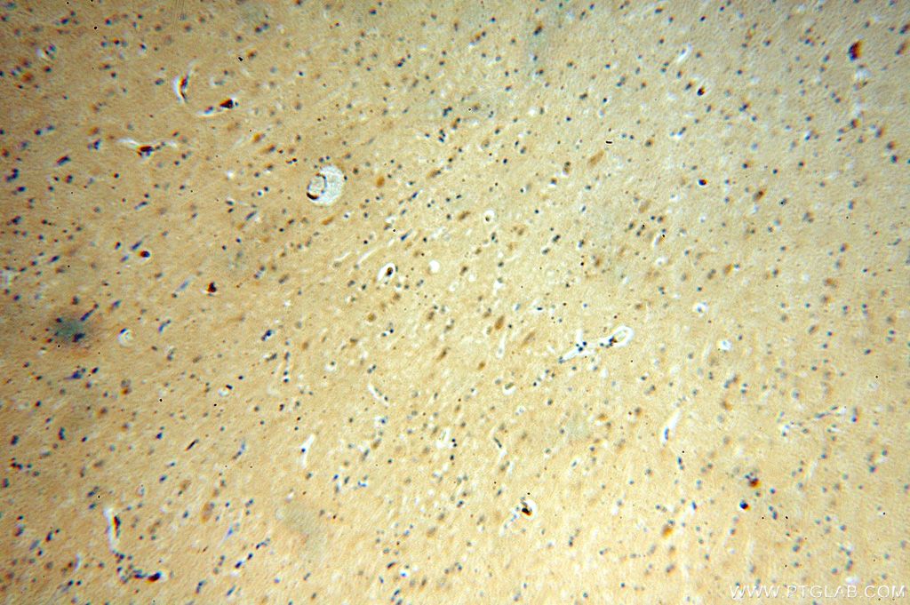 Immunohistochemistry (IHC) staining of human brain tissue using ING4-specific Polyclonal antibody (16188-1-AP)