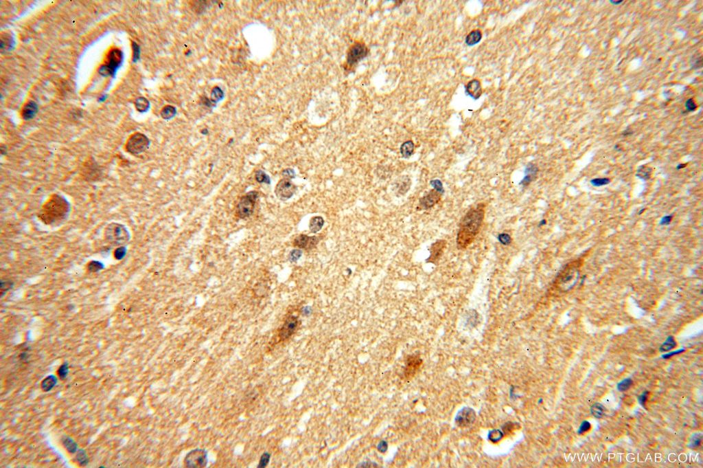 Immunohistochemistry (IHC) staining of human brain tissue using ING4-specific Polyclonal antibody (16188-1-AP)