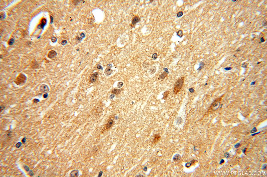 IHC staining of human brain using 16188-1-AP