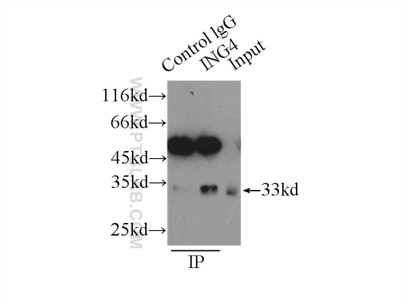 Immunoprecipitation (IP) experiment of HeLa cells using ING4-specific Polyclonal antibody (16188-1-AP)