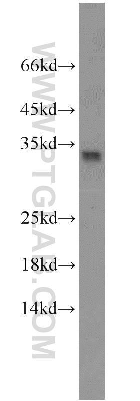 Western Blot (WB) analysis of Jurkat cells using ING4-specific Polyclonal antibody (16188-1-AP)