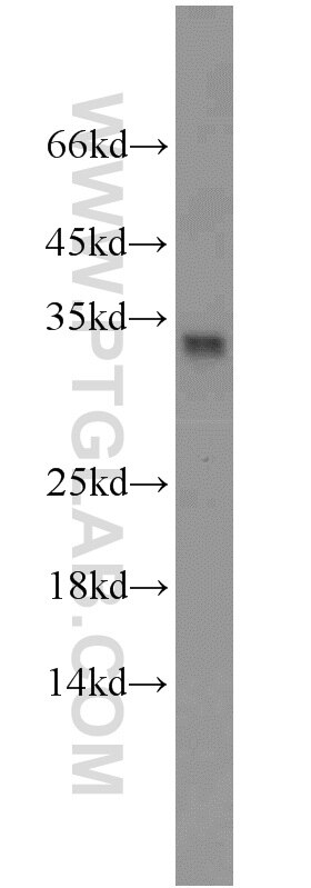 WB analysis of Jurkat using 16188-1-AP
