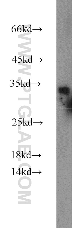 Western Blot (WB) analysis of Jurkat cells using ING4-specific Polyclonal antibody (16188-1-AP)