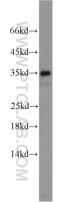 Western Blot (WB) analysis of mouse colon tissue using ING4-specific Polyclonal antibody (16188-1-AP)