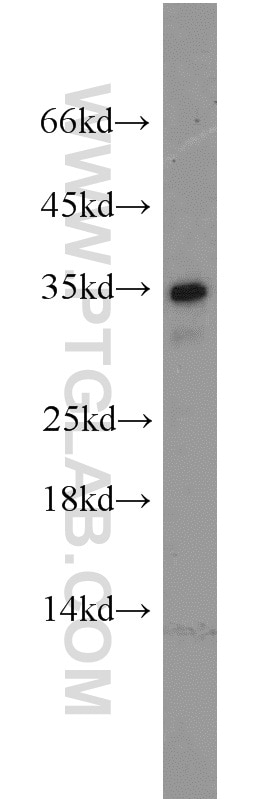 Western Blot (WB) analysis of mouse colon tissue using ING4-specific Polyclonal antibody (16188-1-AP)