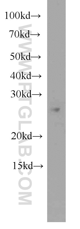 Western Blot (WB) analysis of Jurkat cells using ING4-specific Polyclonal antibody (16188-1-AP)