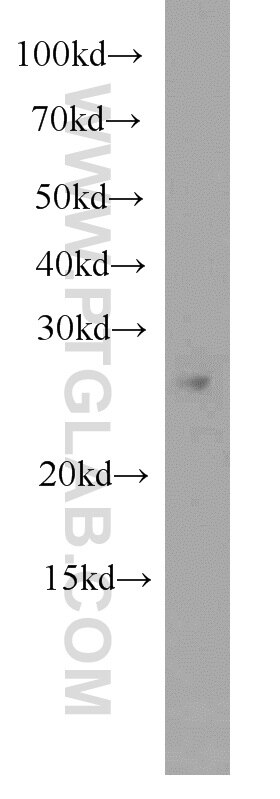 WB analysis of Jurkat using 16188-1-AP