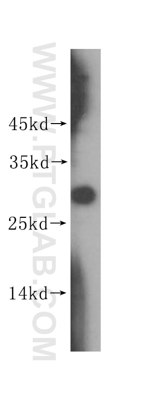 Western Blot (WB) analysis of HeLa cells using ING4-specific Polyclonal antibody (16188-1-AP)