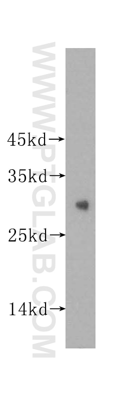 Western Blot (WB) analysis of HEK-293 cells using ING4-specific Polyclonal antibody (16188-1-AP)
