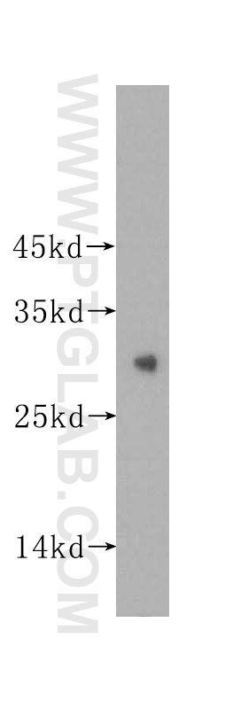 Western Blot (WB) analysis of HEK-293 cells using ING4-specific Polyclonal antibody (16188-1-AP)