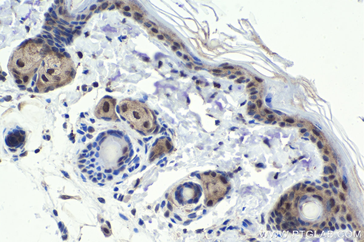 Immunohistochemistry (IHC) staining of rat skin tissue using ING5 Polyclonal antibody (10665-1-AP)