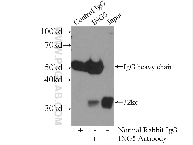 Immunoprecipitation (IP) experiment of HEK-293 cells using ING5 Polyclonal antibody (10665-1-AP)