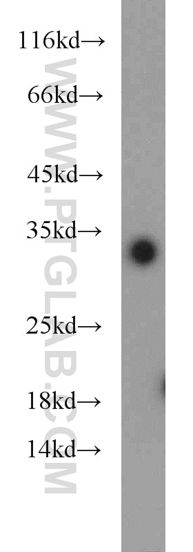 Western Blot (WB) analysis of Jurkat cells using ING5 Polyclonal antibody (10665-1-AP)