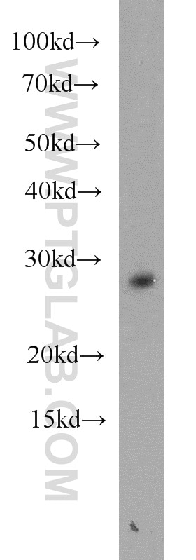 Western Blot (WB) analysis of PC-3 cells using ING5 Polyclonal antibody (10665-1-AP)