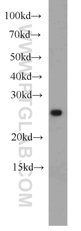 Western Blot (WB) analysis of Jurkat cells using ING5 Polyclonal antibody (10665-1-AP)