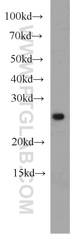 Western Blot (WB) analysis of Jurkat cells using ING5 Polyclonal antibody (10665-1-AP)