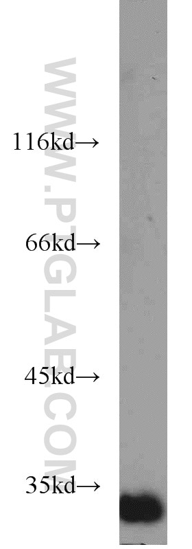 Western Blot (WB) analysis of mouse kidney tissue using ING5 Polyclonal antibody (10665-1-AP)