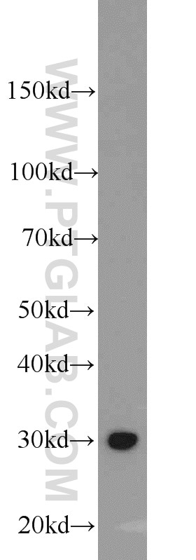 Western Blot (WB) analysis of HEK-293 cells using ING5 Polyclonal antibody (10665-1-AP)