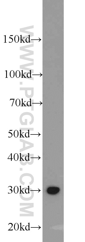 WB analysis of HEK-293 using 10665-1-AP