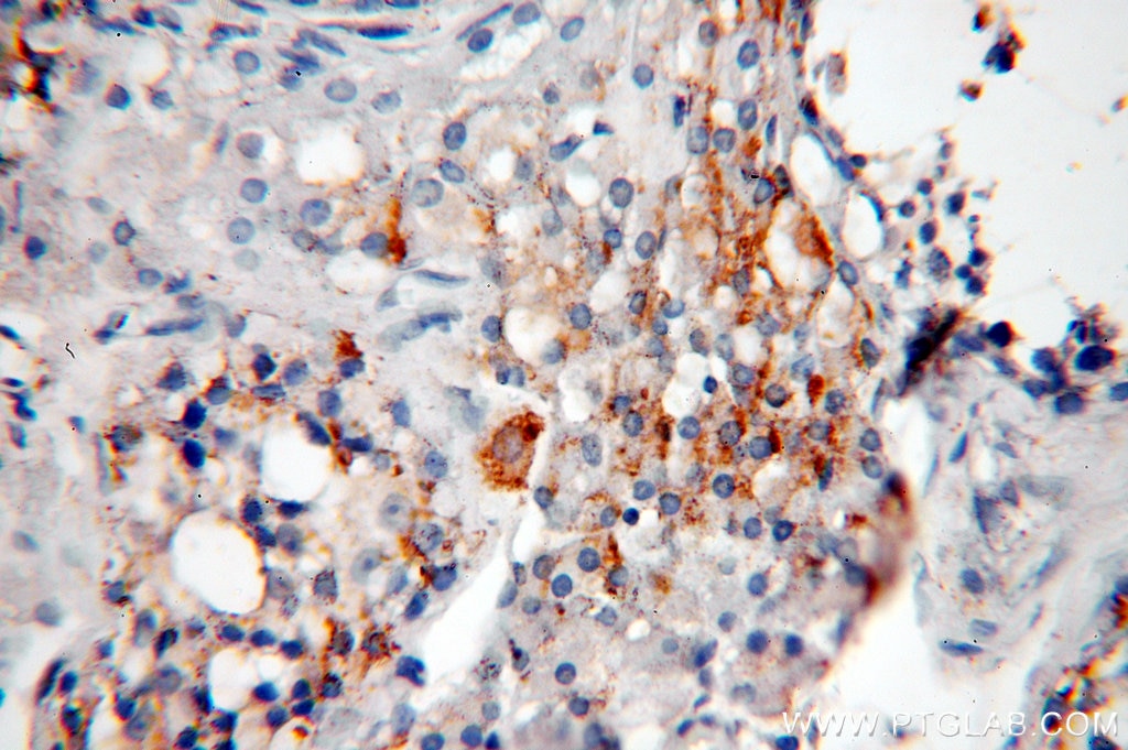 Immunohistochemistry (IHC) staining of human testis tissue using Inhibin Alpha Polyclonal antibody (10609-1-AP)