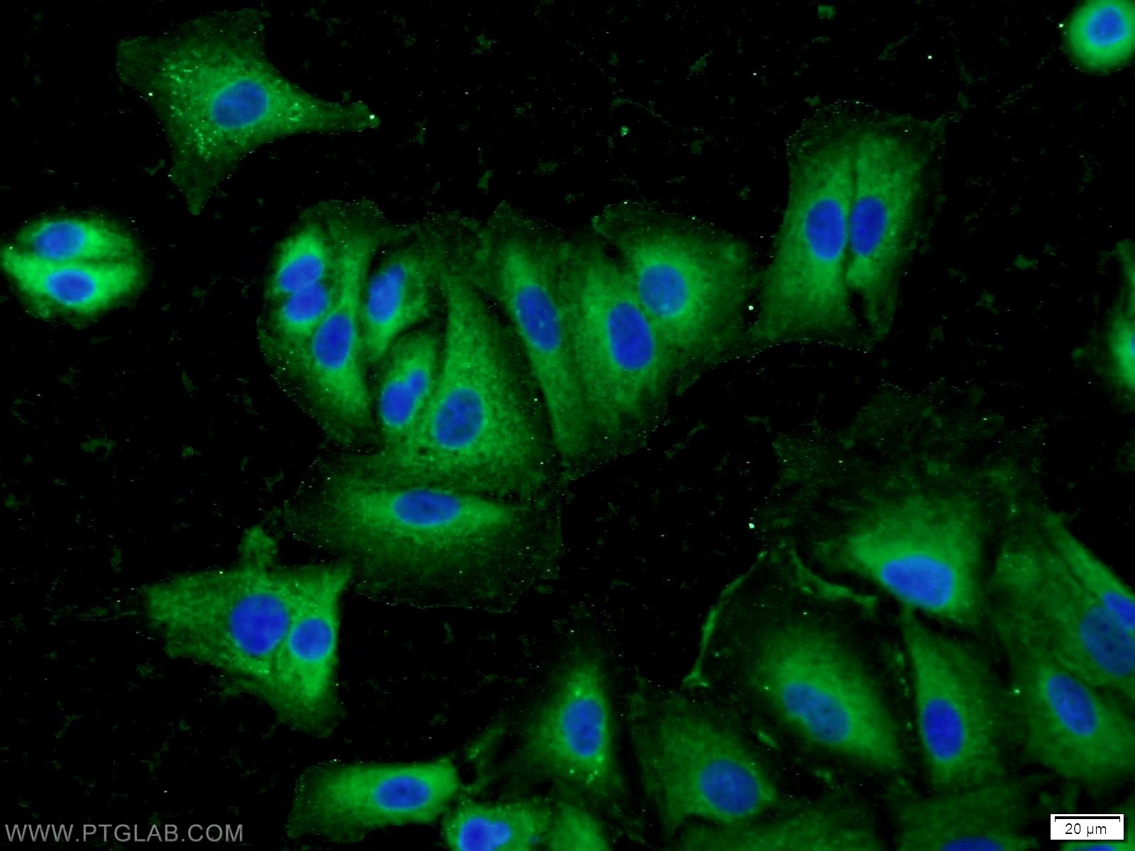 Immunofluorescence (IF) / fluorescent staining of A549 cells using Inhibin Beta A Polyclonal antibody (10651-1-AP)